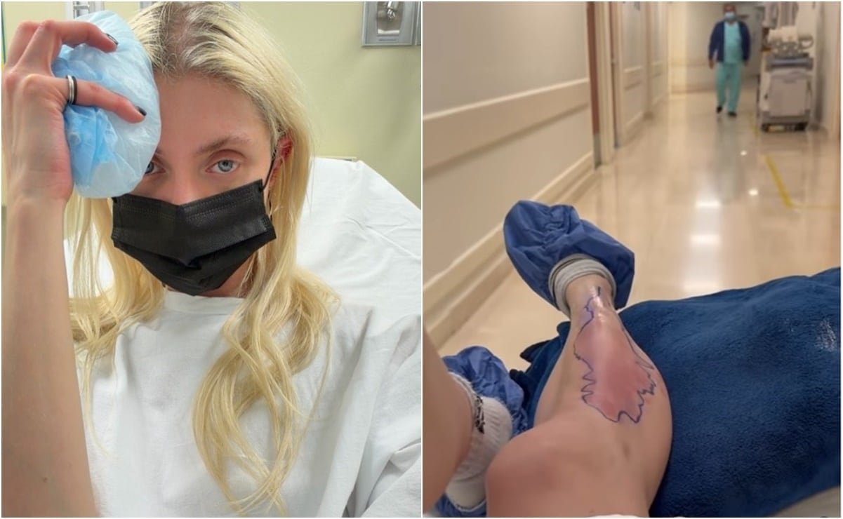 Taylor Momsen picadura araña CDMX