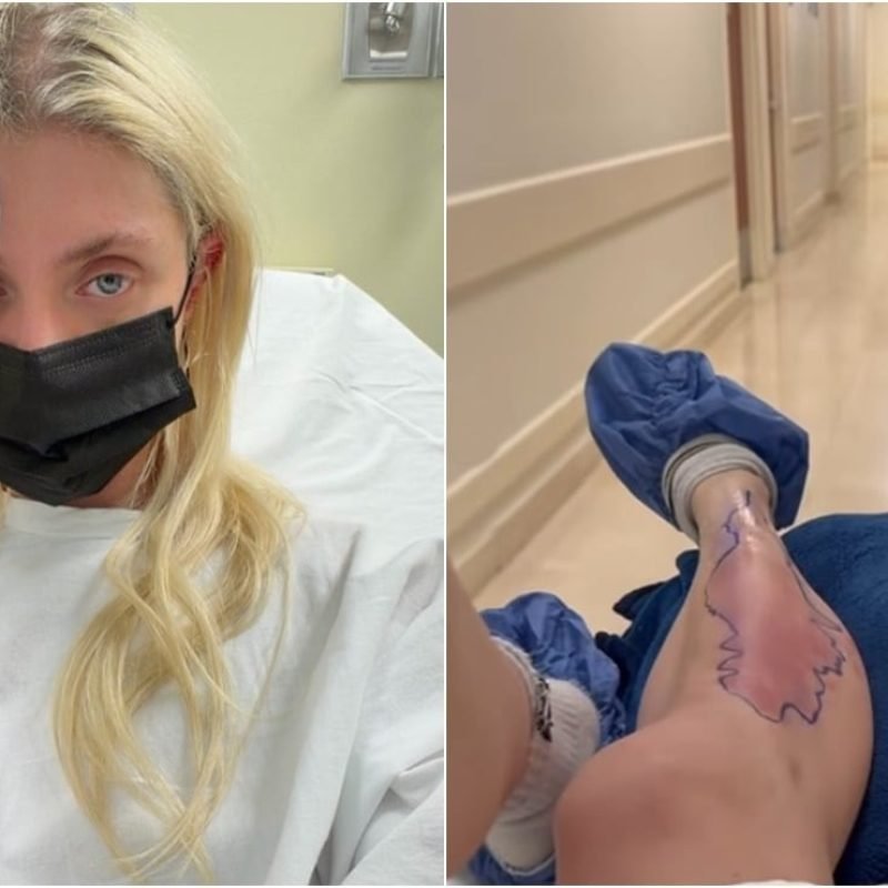 Taylor Momsen picadura araña CDMX