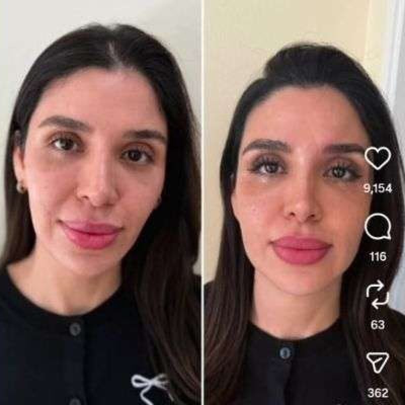 emma-coronel-nuevo-look-tratamiento-estetico