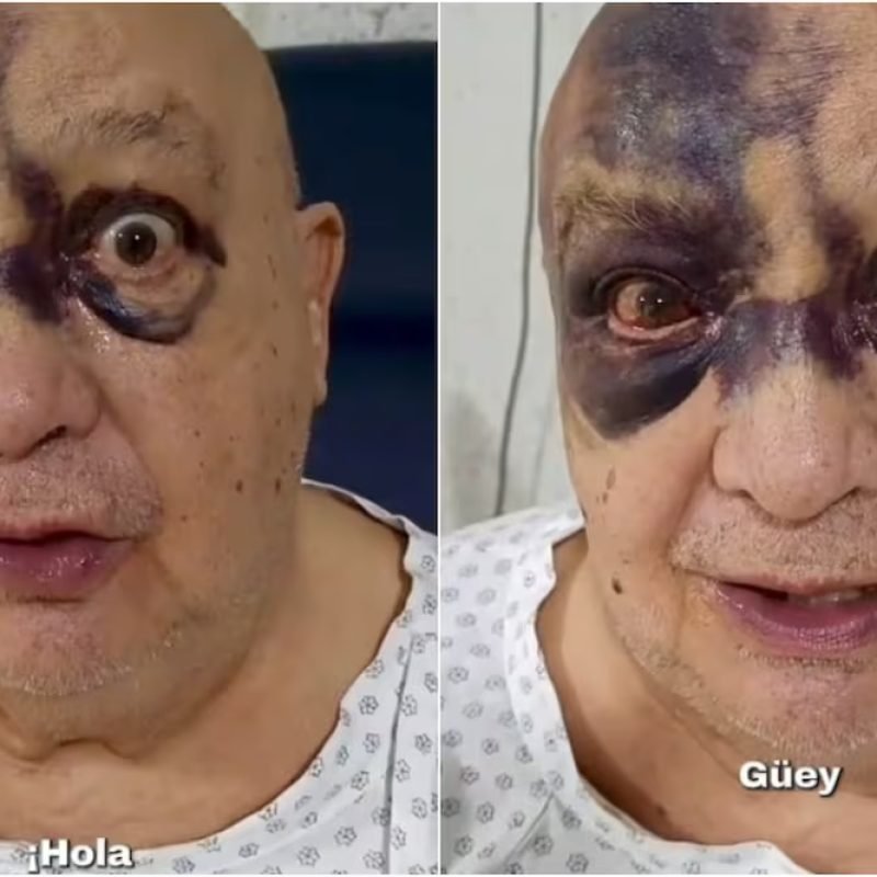 luis-de-alba-accidente